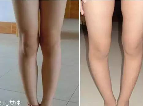 长腿光环背后的真实人生 探秘世界纪录保持者的甜蜜与烦恼